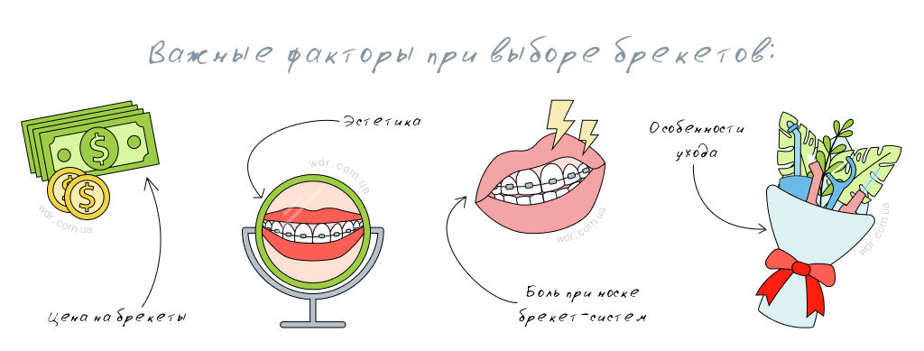 Какие брекеты лучше ставить детям и взрослым — WDR